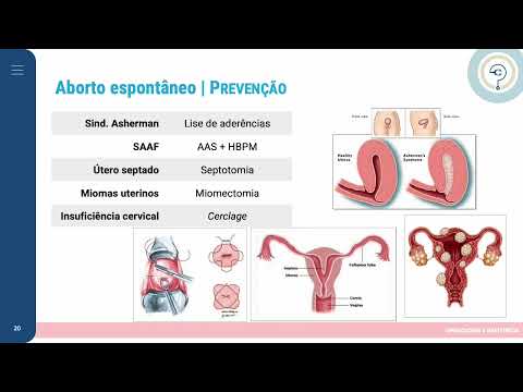 Ginecologia/Obstetrícia - Abortamento e Gravidez Ectópica - Revalidação 2022