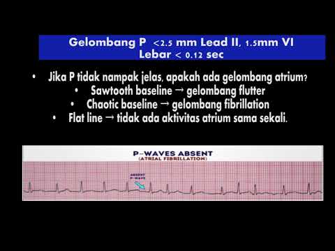 Video: Cara Menjadi Juruteknik ECG: 10 Langkah (dengan Gambar)