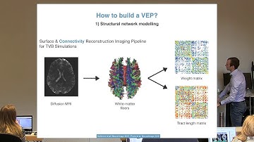 TVB Node 6 - Berlin: Julie Courtiol - Clinical applications of The Virtual Brain - Epilepsy