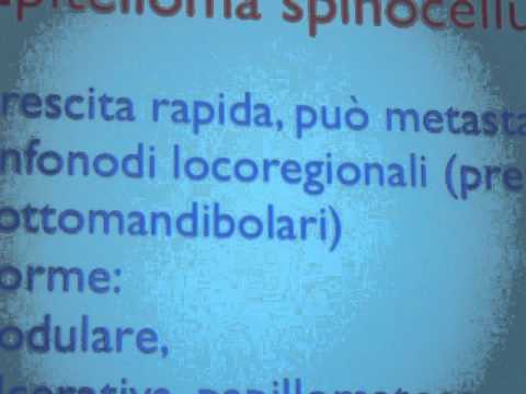 ENTROPION, ECTROPION E TUMORI DELLA PALPEBRA