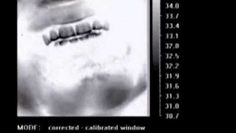 Thermal Infrared Imaging - Software