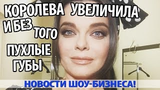 НАТАША КОРОЛЕВА УВЕЛИЧИЛА И БЕЗ ТОГО ПУХЛЫЕ ГУБЫ НАТАША КОРОЛЕВА УВЕЛИЧИЛА И БЕЗ ТОГО ПУХЛЫЕ ГУБЫ