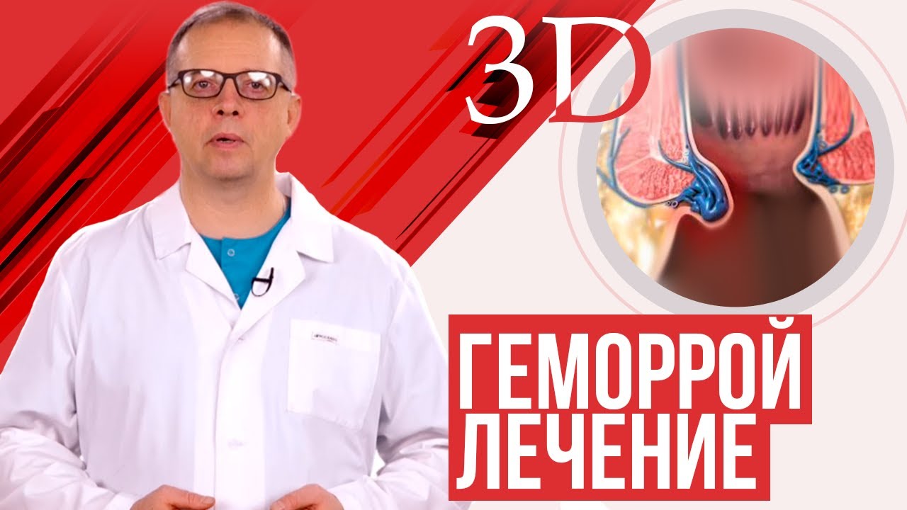 Лечение геморроя 4