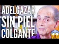Episodio #2024 Adelgazar Sin Piel Colgante