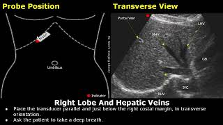 Liver Ultrasound Probe Positioning | Transducer Placement For Liver Scanning | Abdominal USG screenshot 5
