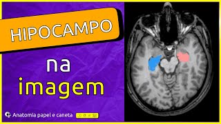 Aprenda a identificar o HIPOCAMPO em exames de imagem