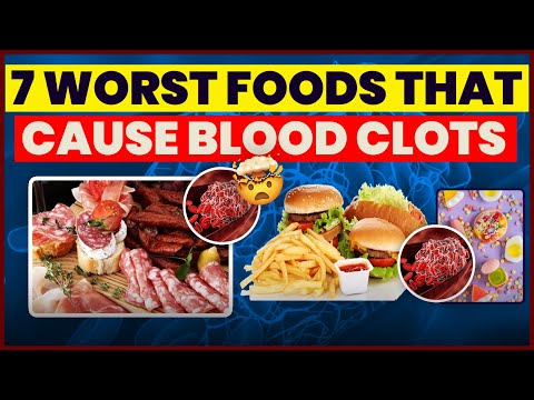 7 Worst Foods that Cause Blood Clots