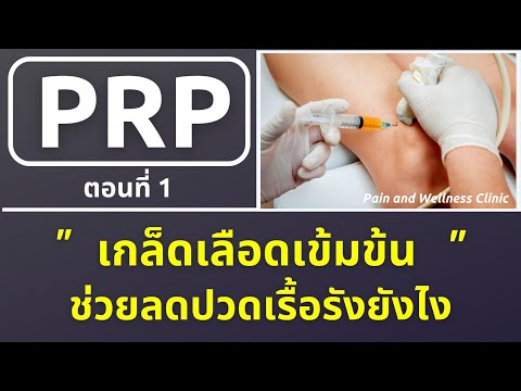ฉีดเกล็ดเลือดเข้มข้น หรือ PRP ช่วยลดปวดเรื้อรัง ปวดเข่า ปวดเส้นเอ็น ได้ยังไง (ตอนที่ 1)