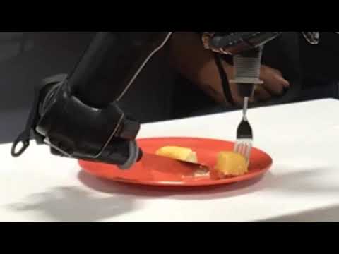Shared Control of Bimanual Robotic Limbs With a Brain-Machine Interface for Self-Feeding