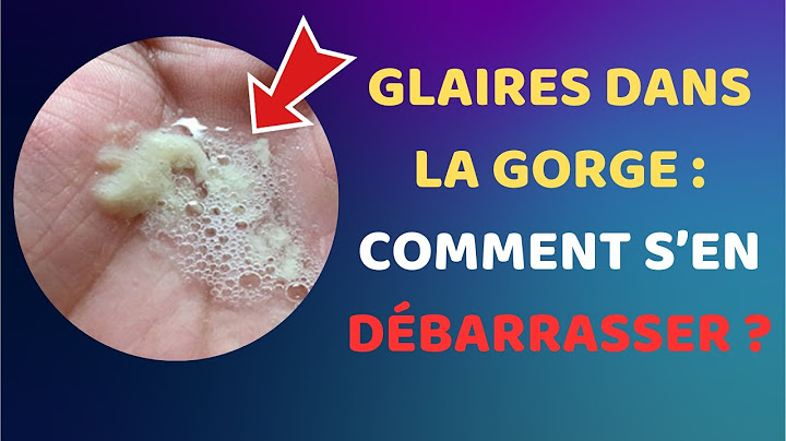 Comment se débarrasser des glaires dans la gorge ? Les remèdes naturels et efficaces |Fact24h