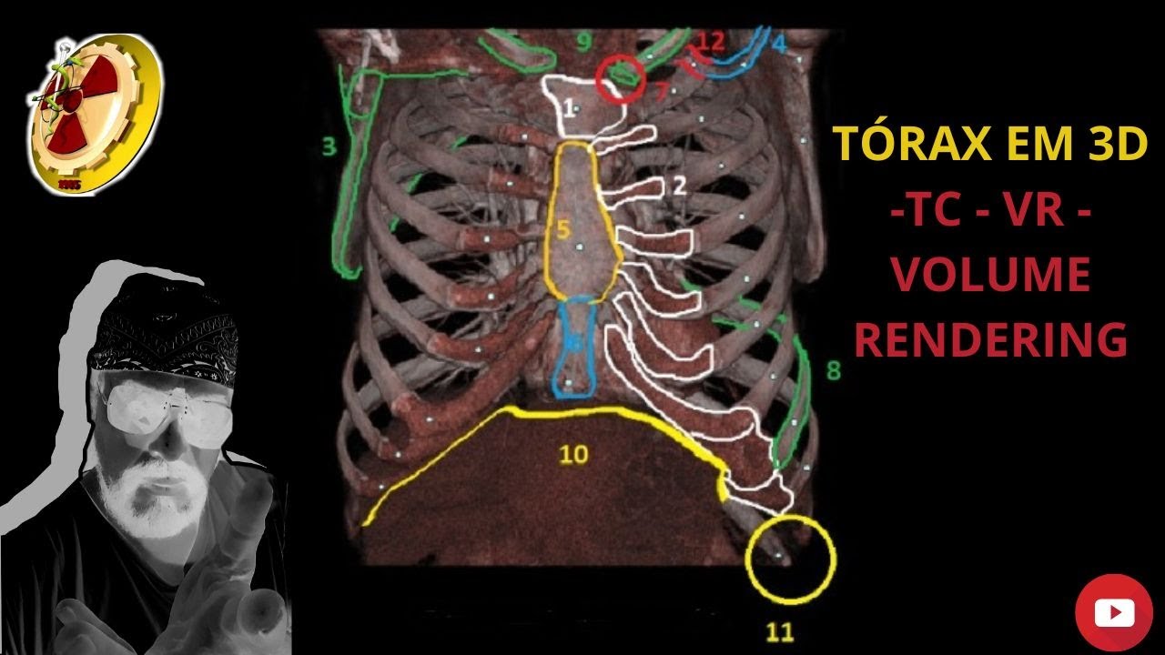 Tórax em 3D TC VR Volume rendering - YouTube