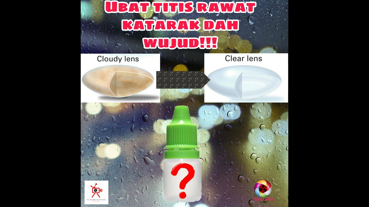 Doktor Mata : Ubat titis rawat katarak dah wujud!
