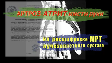 АРТРОЗ КИСТИ РУК (артроз лучезапястного сустава) на РАСШИФРОВКЕ МРТ лучезапястного сустава