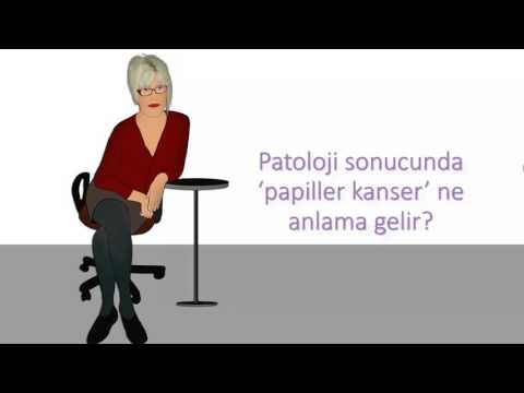 Patoloji sonucunda ‘papiller kanser’ ne anlama gelir