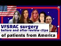 VFSRAC surgery before and after review clips of patients from America