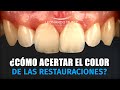 ¿Cómo acertar el color de las restauraciones?