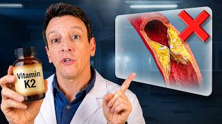 The Truth About Vitamin K2 and Your Arteries (New Study)