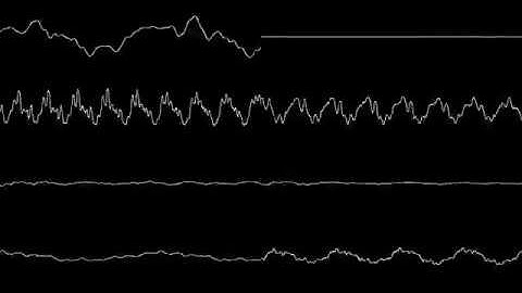 Super Mario RPG - Let