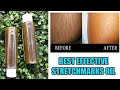 How to make stretchmarks eraser oil for stubborn stretchmarks and scars and cellulite