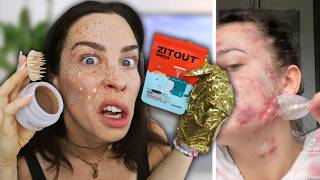 Ich teste VIRALE HYPE PRODUKTE!