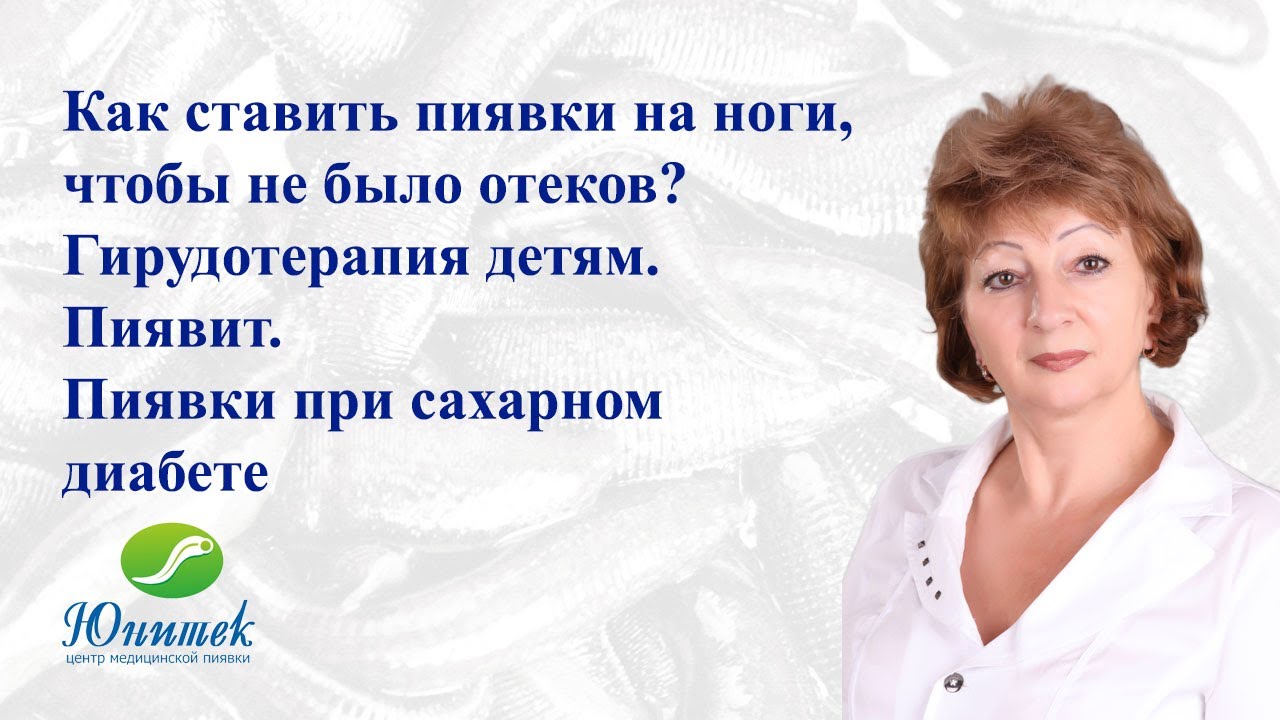 Семинар с Дугенец Галиной Васильевной. Как ставить пиявки на ноги, чтобы не было отеков?