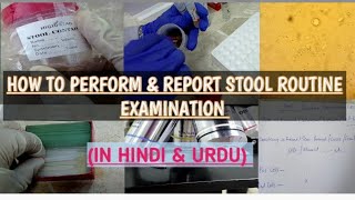 Stool Examination. Routine & Microscopy.Reporting of stool examination.(In Urdu & Hindi).
