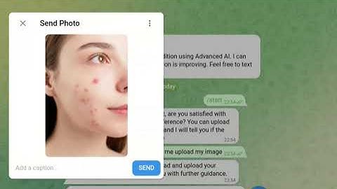 Skin Condition Analyzer Telegram Bot