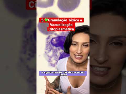 Vídeo: O que é vacuolização citoplasmática?