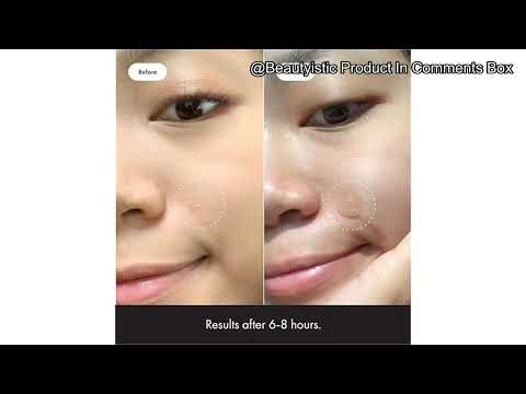 Mighty Patch™ Original Review: Does This Acne Patch Really Deliver on Clearer Skin Overnight?