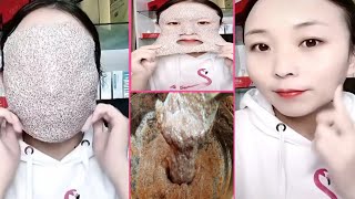 Viral Japanese Secret Skin whitening and Get rid of Pigmentation, Get White complexion - Natural You