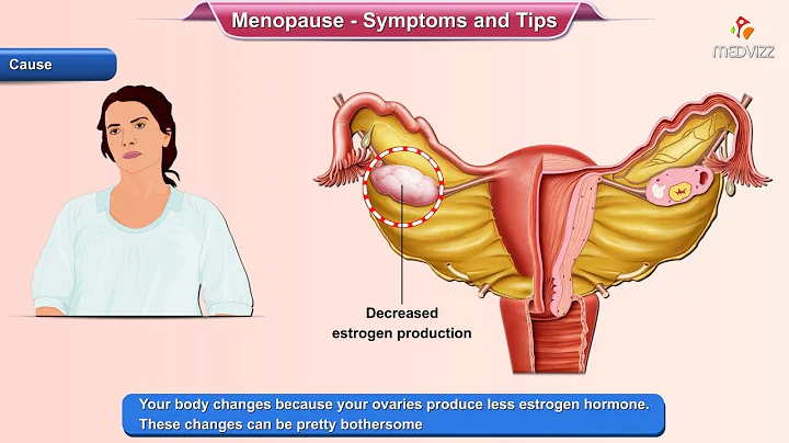 Menopause Symptoms - Ways to Deal With it - DayDayNews