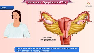 Menopause Symptoms - Ways to Deal With it