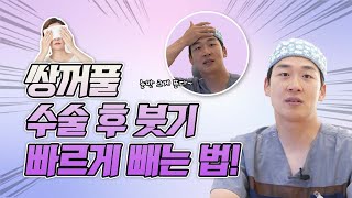 [광주성형외과비비드] 눈붓기는 스피드가 생명 !! - 광주쌍수