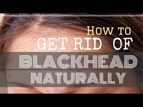 Blackhead Removal on Forehead | How to Get Rid of Blackhead Naturally