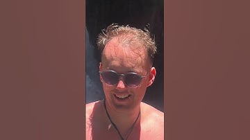 Going Bald Transformation (NO BEARD!)
