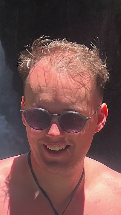 Going Bald Transformation (NO BEARD!)