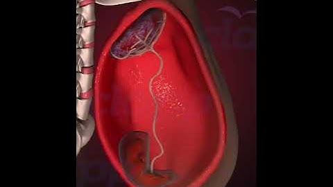 Placenta (3D Animation)