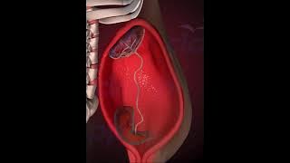 Placenta (3D Animation)