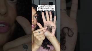 My 1 Month Results of Shed Hair from Using Onion Juice for Hair Growth #hairgrowth #onionjuice