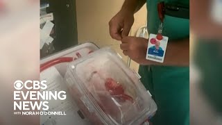 New technology revolutionizes heart transplants