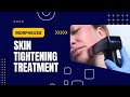 Morpheus8 | Skin Tightening Treatment | West Hollywood, CA | Dr. Jason Emer