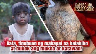 Bata, tinubuan ng makapal na balahibo at buhok ang mukha at katawan! | Kapuso Mo, Jessica Soho