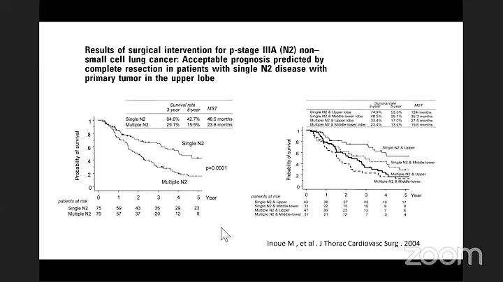 Stage III NSCLC, Dr. Munera Alhussani, PSMMC