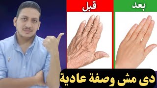 تفتيح + ترطيب + تنعيم + التخلص من تجاعيد اليدين بوصفة مذهلة فى دقائق بالمنزل