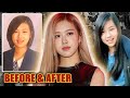 BlackPink Rosé: Plastic Surgery (2020) - Lifting The Veil