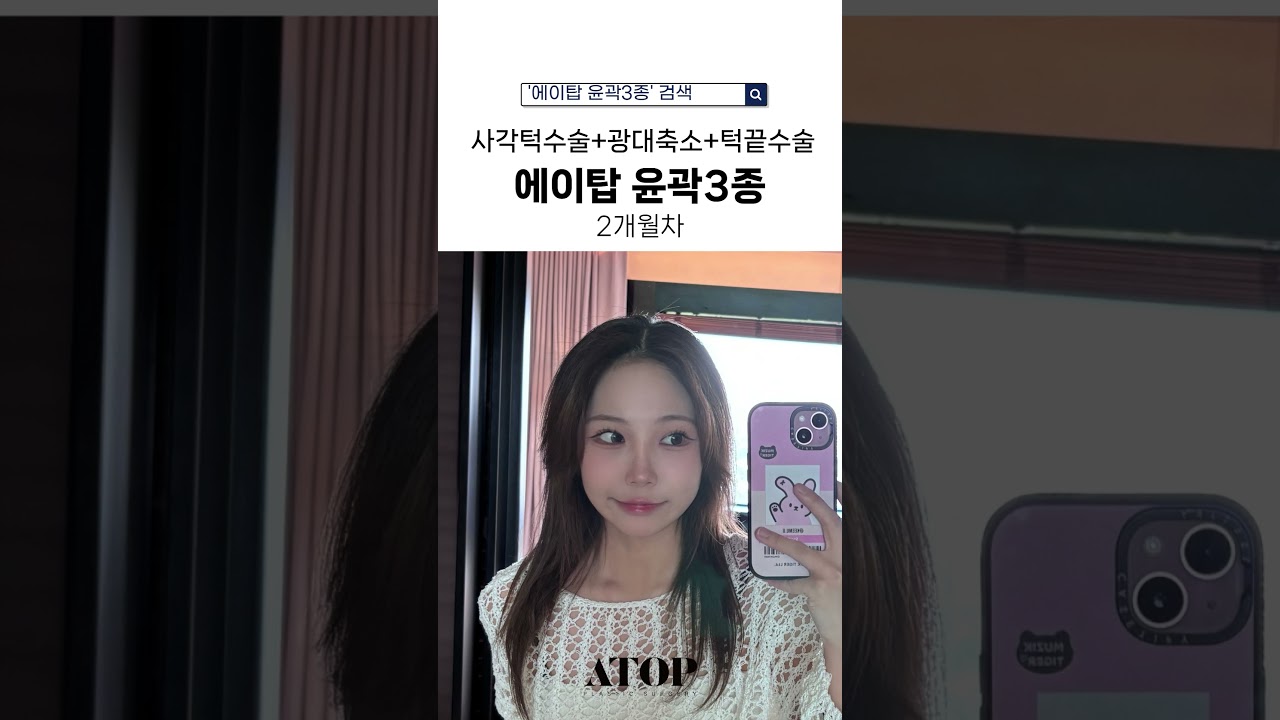 [Эйтоп гоо сайхны мэс заслын эмнэлэг] Эйтоп нүүрний 3 цэгийн тойм засал хийлгэсэн сэтгэгдэл