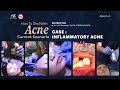 Teaching class batch 08 case inflammatory acne