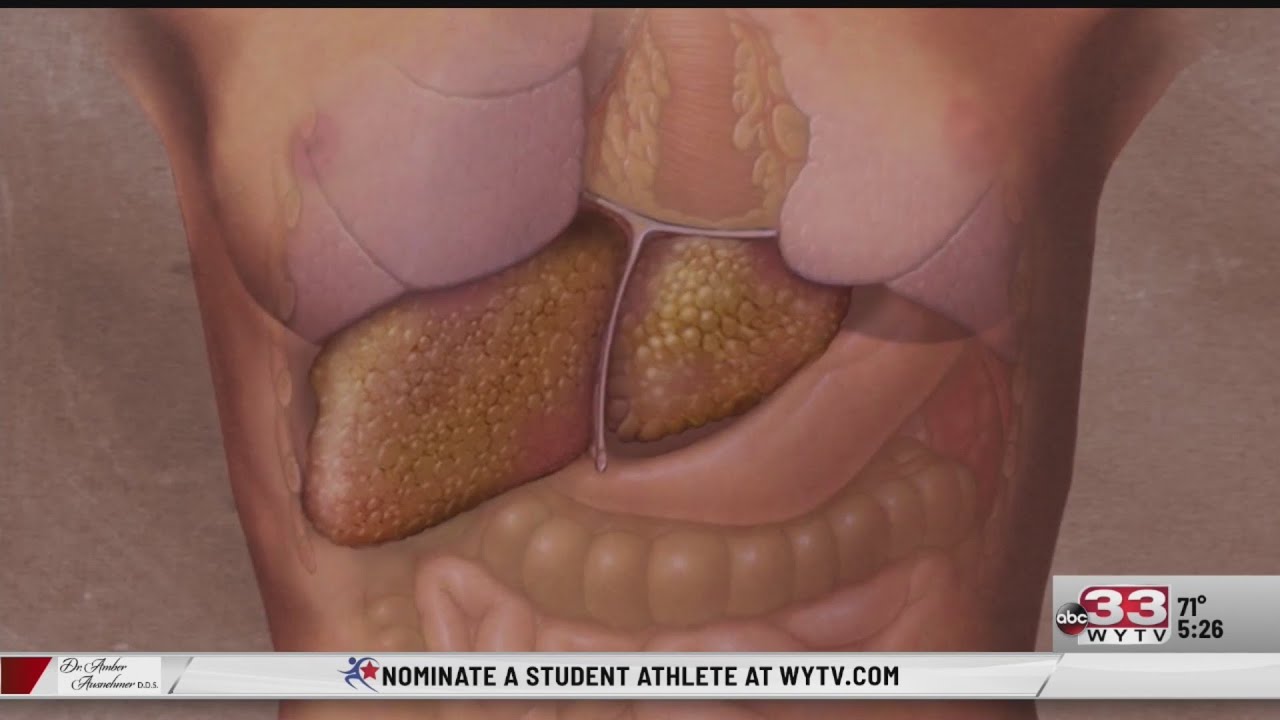 Len Rome's Local Health: Different types of Hepatitis