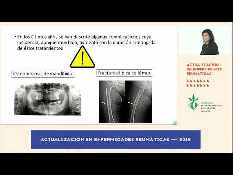 Vídeo: SERM: Beneficios Para La Osteoporosis, El Cáncer De Mama Y Más, Efectos Secundarios