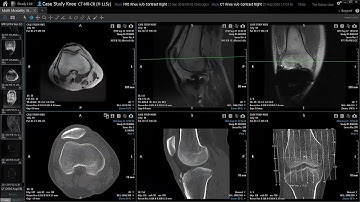 Vitrea Applications Overview | Multi Modality Viewer